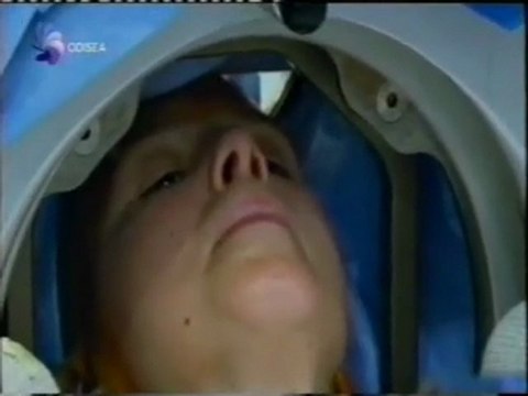 Neurocirugia del TOC: Estimulacion cerebral profunda