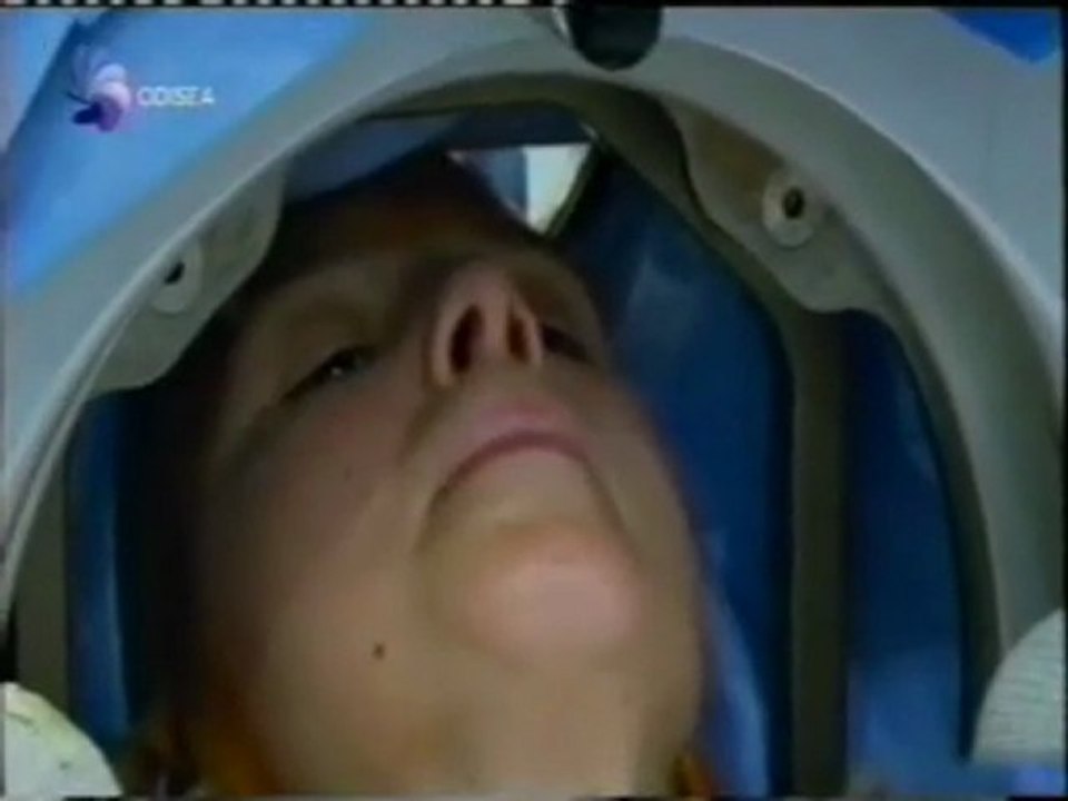 Neurocirugia del TOC: Estimulacion cerebral profunda