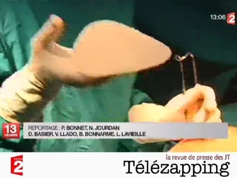 Télézapping : Le silicone PIP était utilisé comme isolant électrique