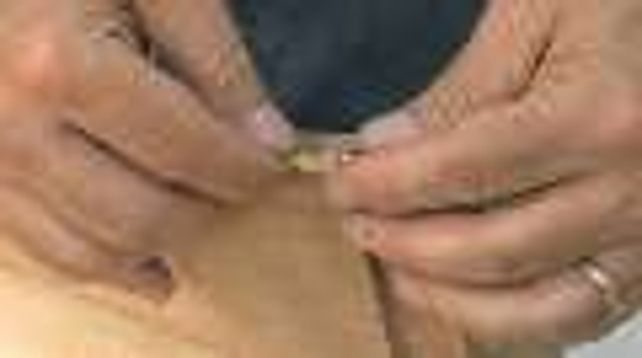 Fixing Woodworking Mistakes