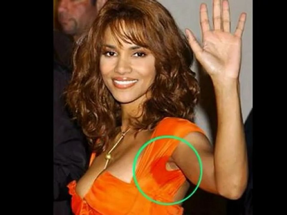 How Can You Stop Excessive Underarm Sweating?