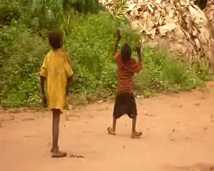Quand la maladie du pian ronge les enfants pygmées_1 Vidéo Dailymotion