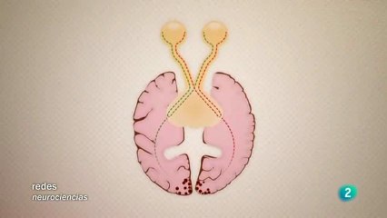 Vision ciega: Ceguera cortical