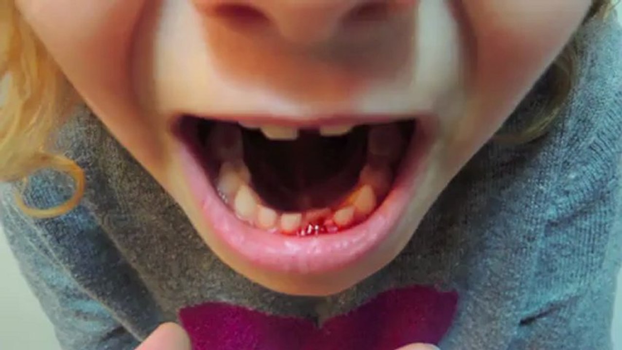 une fille arrache sa dent avec un circuit électrique