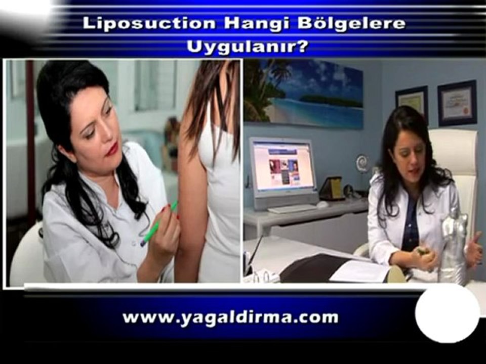 Liposuction Hangi Bölgelere Uygulanır_ Op.Dr.Eser Aydoğdu