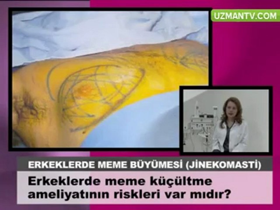 Op Dr Eser Aydogdu meme kucultme ameliyatinin riskleri var m