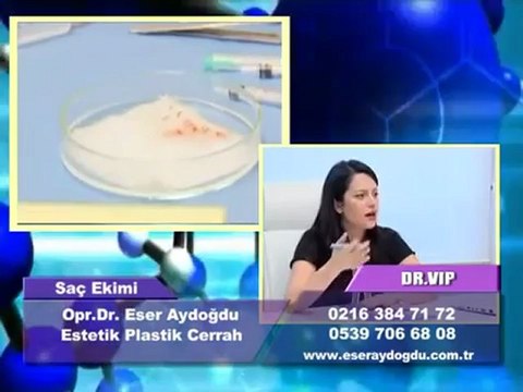 OP DR ESER AYDOĞDU SAÇ EKİMİ HAKKINDA BİLGİ VERİYOR