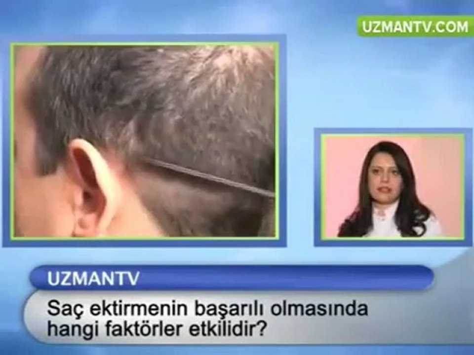 OP DR ESER AYDOĞDU SAÇ EKTİRMENİN BAŞARILI OLMASINDA HANGİ F