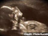 Catholic Hospital Argues Fetuses Are Not People