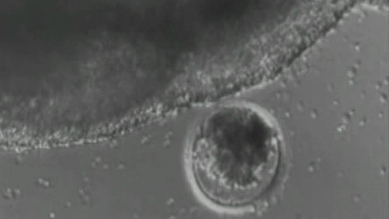 Jouston feat. Dion - High5 (Körperzellen Mix)