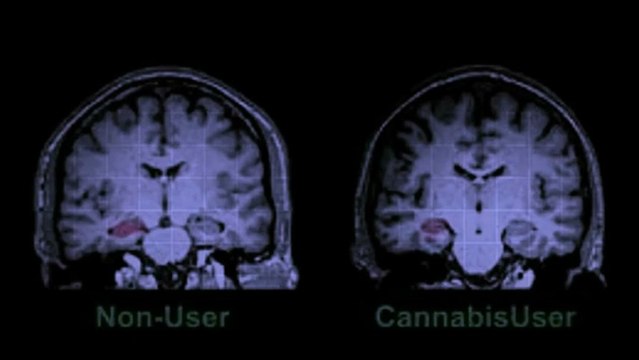 Expert Seed Bank - Health Effects of Cannabis Strains