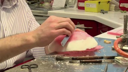 Malala passa por cirurgias reconstrutivas