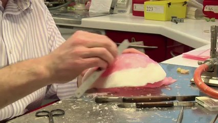 Doctors describe how they will repair Malala's skull