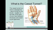 Conquering Carpal Tunnel Syndrome - What is Carpal Tunnel Syndrome?