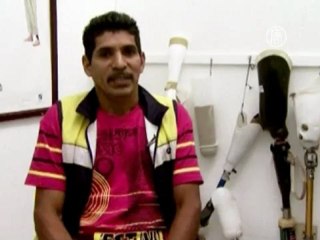 Новая рука за полцены