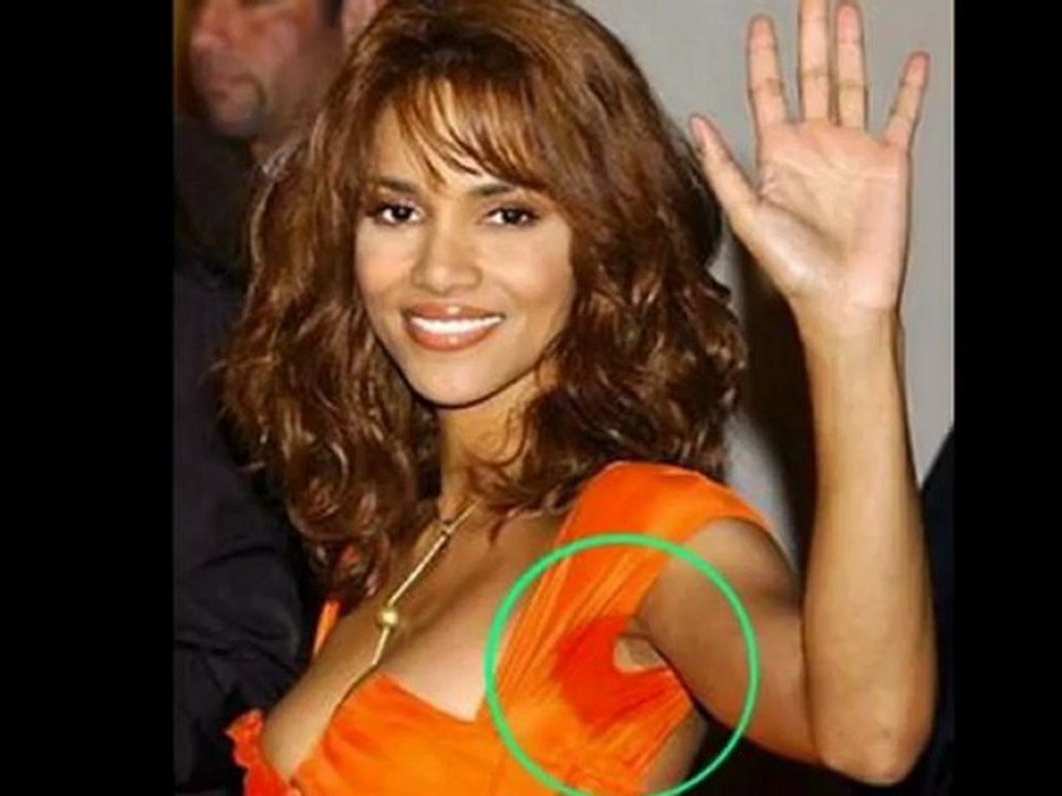 Remedies to Stop Sweaty Armpits