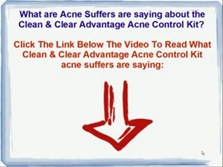 Clean &; Clear Advantage Acne Control Kit