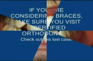 Hamilton Braces - Some cool examples of orthodontic cases