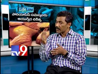 Homeo treatment for Psoriasis - Life Line