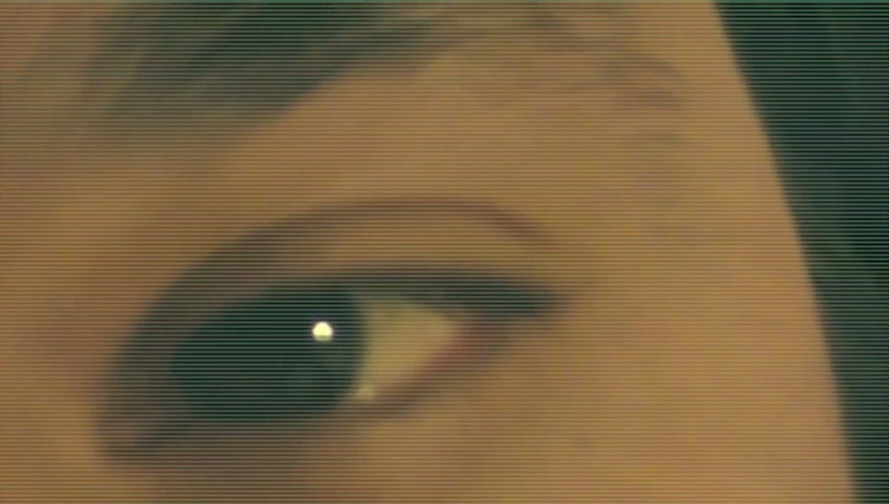 The eye