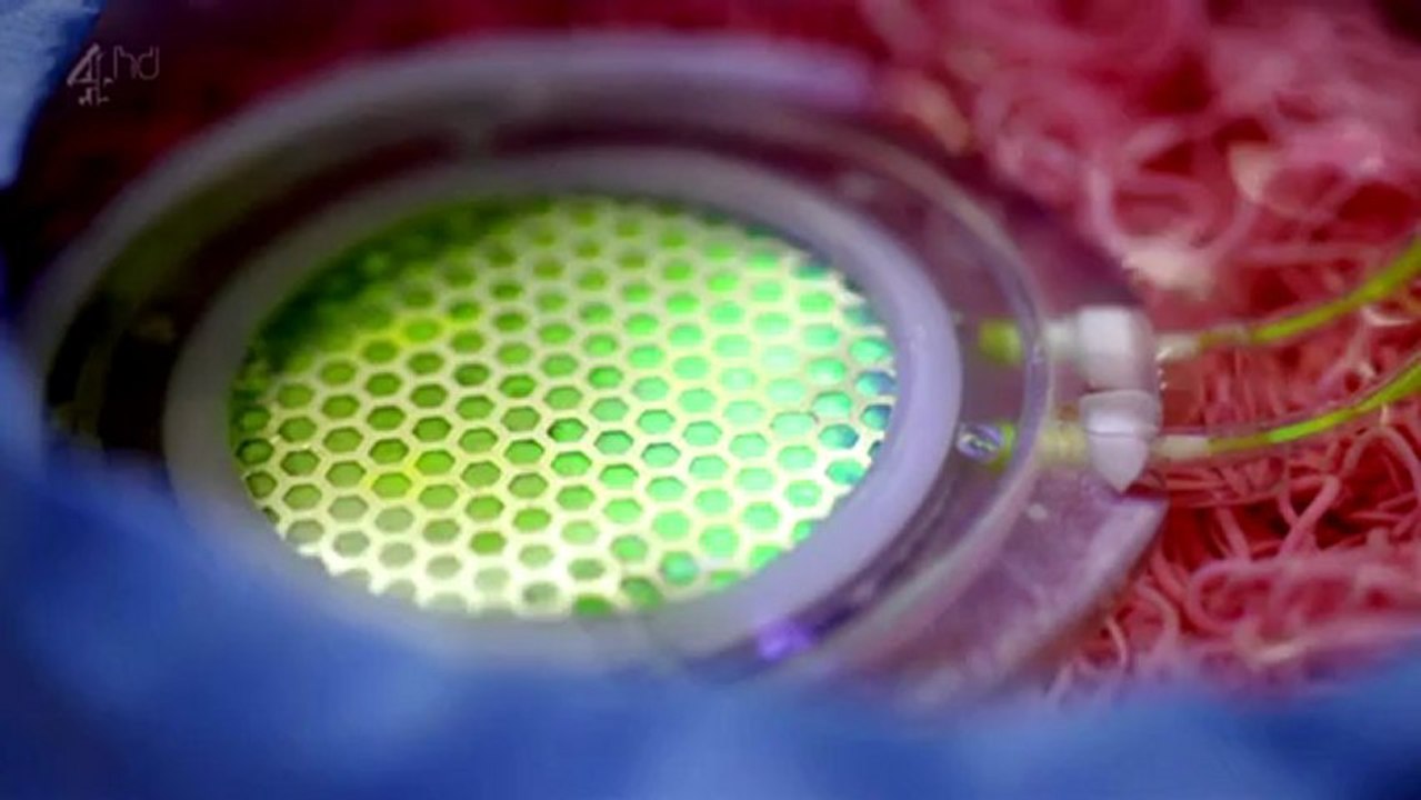 How To Build A Bionic Man