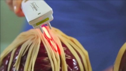 How does the HairMax LaserComb work? Stop Hair Loss now.