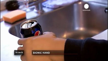 Meet Rex - the world's first real bionic man