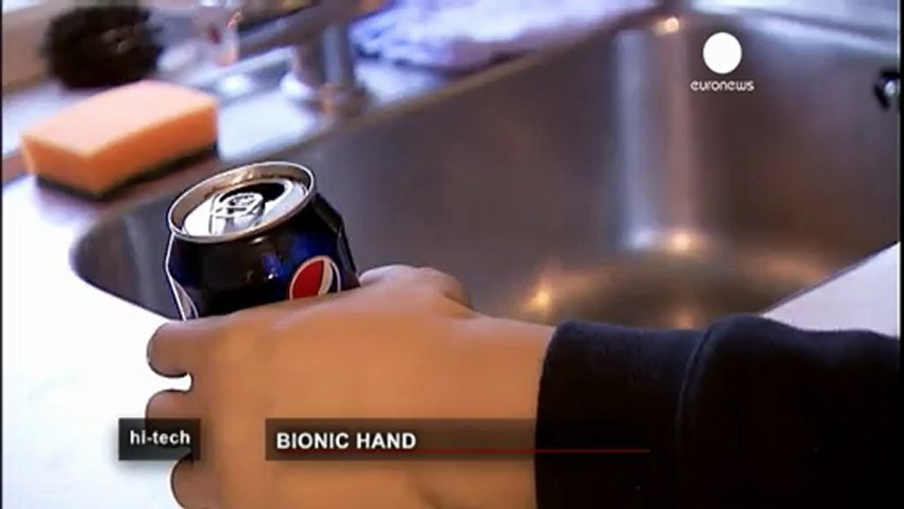 Meet Rex - the world's first real bionic man