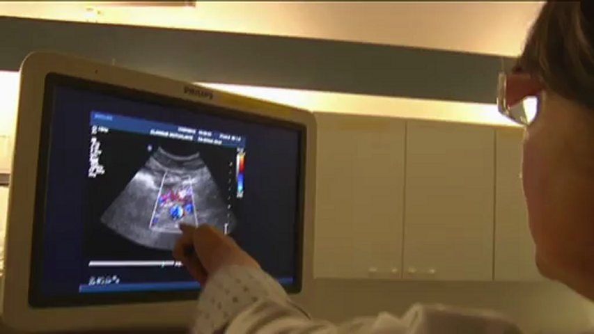Santé : Interview du Docteur Marie-Pierre Pedelucq, angéiologue, l'échographie comme moyen de dépistage de l'anévrisme de l'aorte abdominale