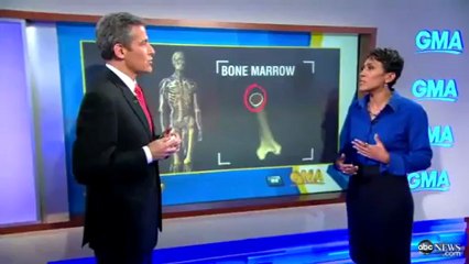 Radiation Effects on Body - JapanRetailNews