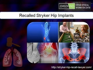 Johnson & Vines – Find Best Stryker Hip Recall Lawyers