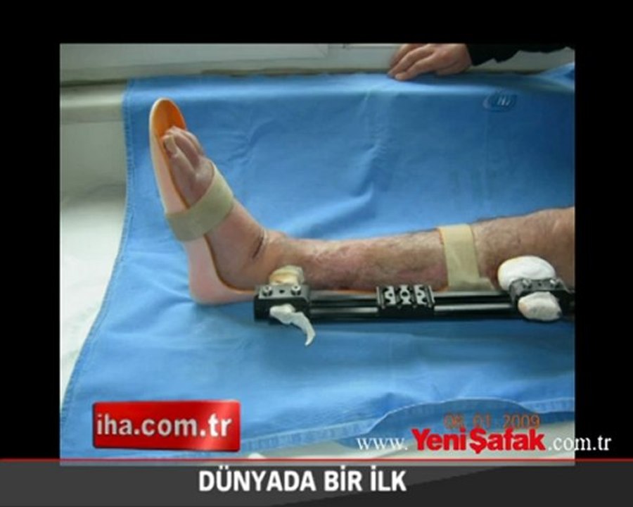 Dünyada bir ilk