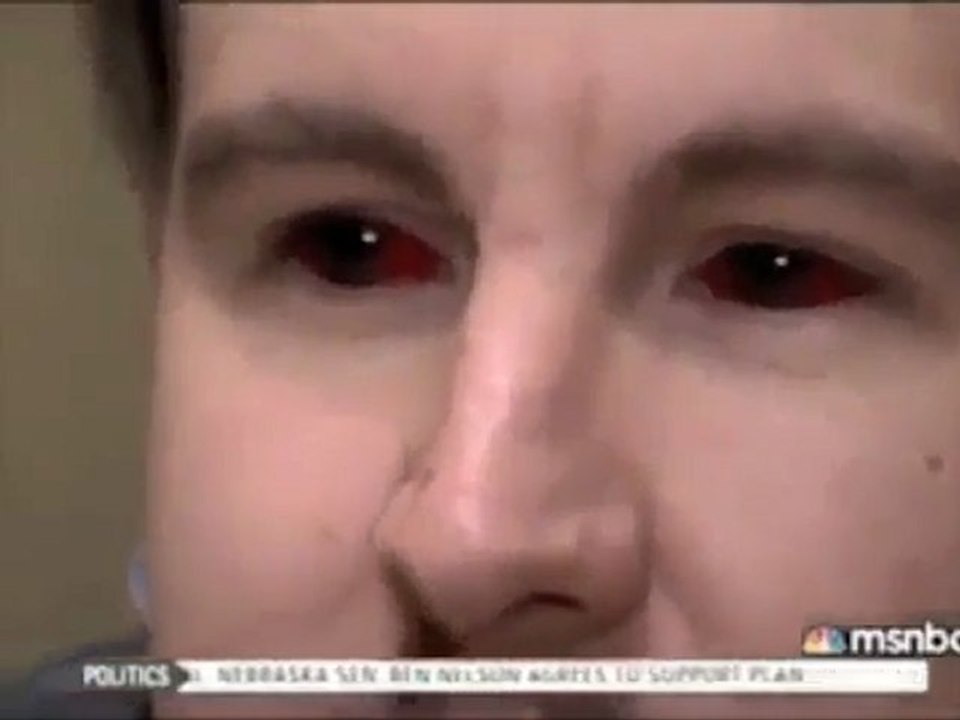 Tatouage dans l'oeil / Eye Tattoos