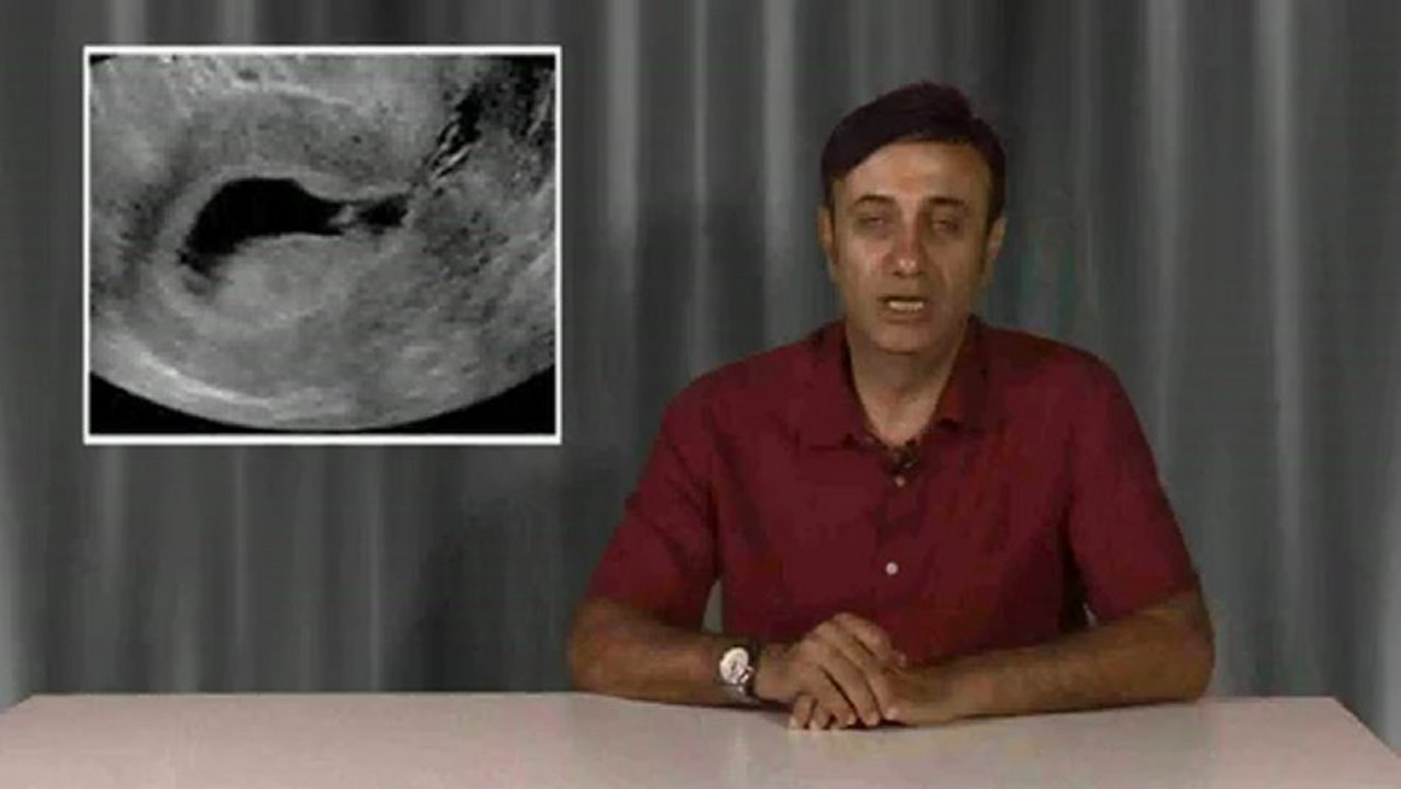 Salin infüzyon sonografi, Sulu ultrason, SİS hangi rahim hastalıklarının teşhisinde kullanılır?