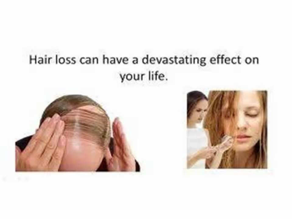 Hair Loss Black Book:Stop Thinning Hair To Cure Hair Loss
