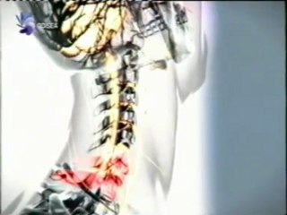 Lesion medular: Rugby paralimpico