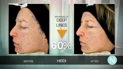 Nerium Heidi Real Results Nerium Reviews