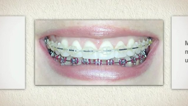 Fort Lauderdale Orthodontist Feb2013