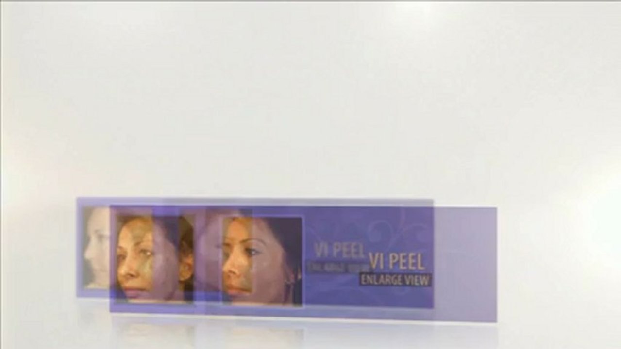 Restore the Youthful Look