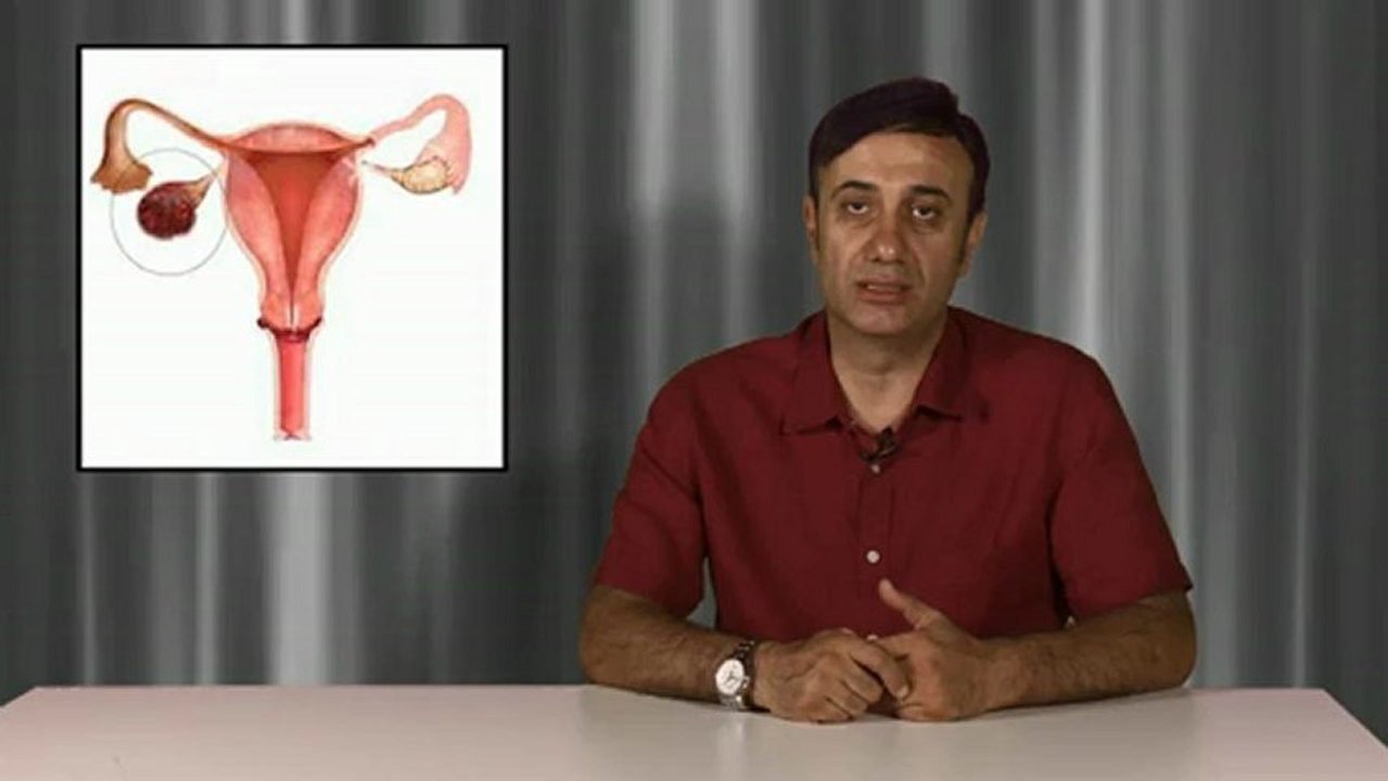 Yumurtalık (over) kanseri nasıl belirti verir?