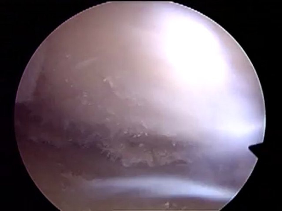 Video_001