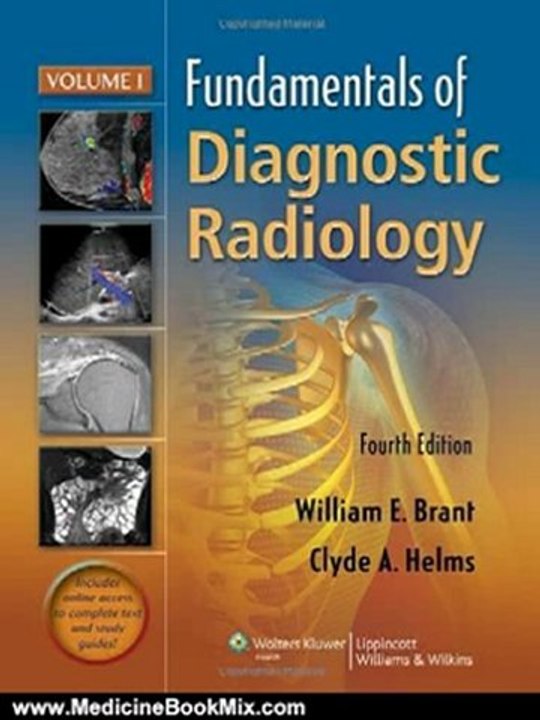 Medicine Book Review: Fundamentals of Diagnostic Radiology - 4 Volume Set (Brant, Fundamentals of Diagnostic Radiology) by William E Brant, Clyde Helms