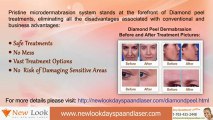 Diamond peel Dermabrasion in Newlook Day Spa And Laser