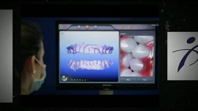 Port Coquitlam Invisalign Jan2013