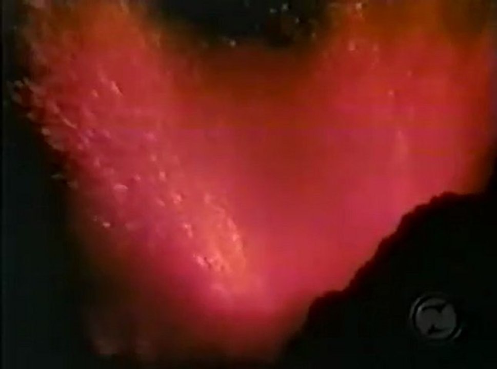 Revenu de l'enfer: des témoignages