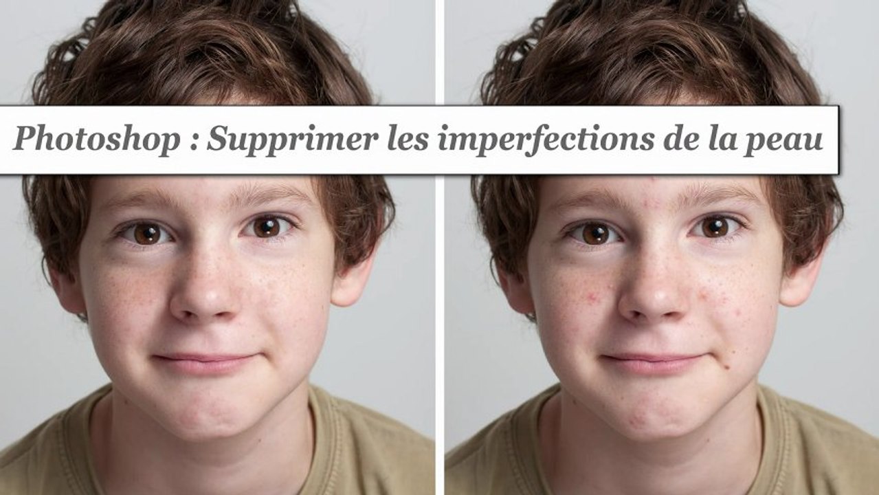 Photoshop : Supprimer les imperfections de la peau - HD