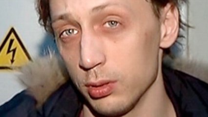 A Ballet Dancer's Acid Attack