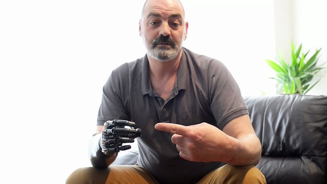 Nigel Ackland et son bras Bionic Terminator