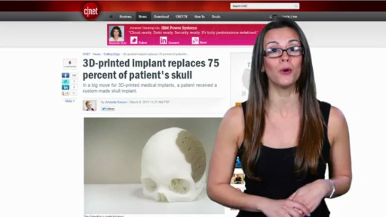 TigerDirect TV: Tech Juice TiVo Mini, Marvel Comic's Project Gamma, 3D Printed Medical Implants