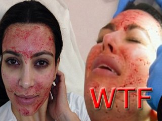 WTF Vampire Facial For Kim Kardashian